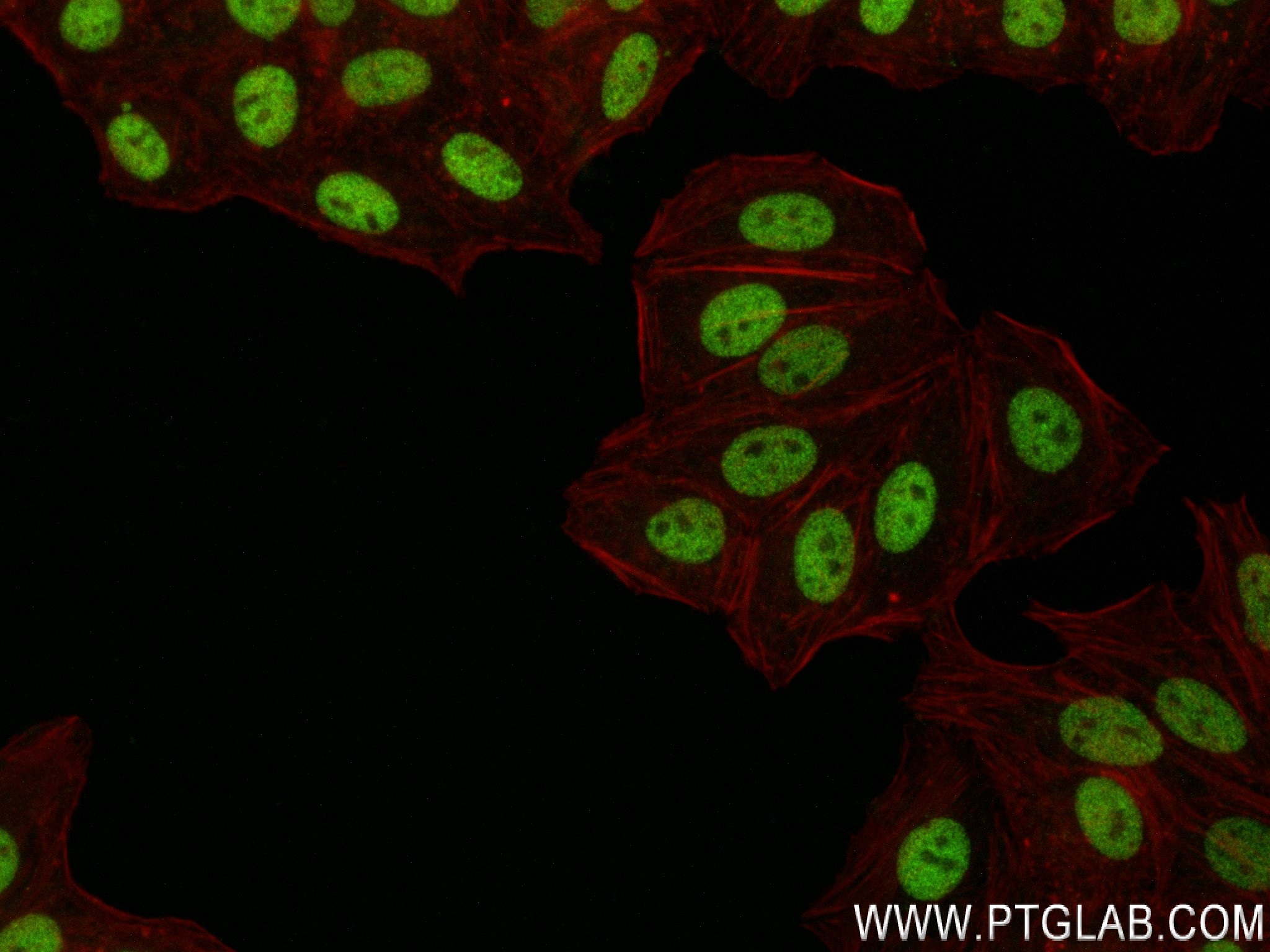 IF Staining of HepG2 using 84276-1-RR (same clone as 84276-1-PBS)