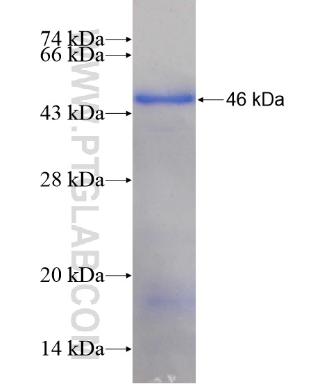 ZNF217 fusion protein Ag19468 SDS-PAGE