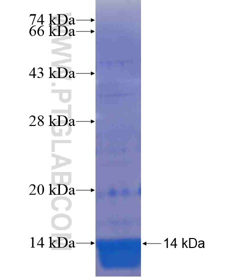 ZNF224 fusion protein Ag21011 SDS-PAGE