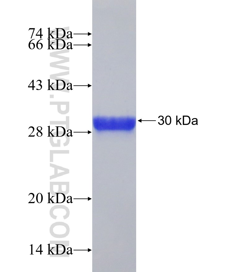 ZNF224 fusion protein Ag21022 SDS-PAGE