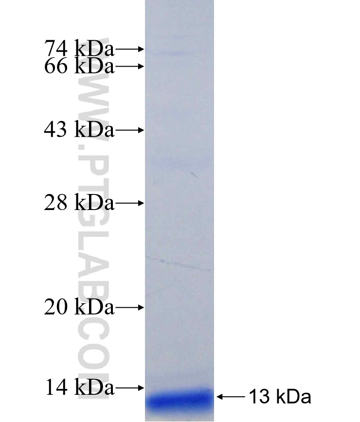 ZNF224 fusion protein Ag31177 SDS-PAGE