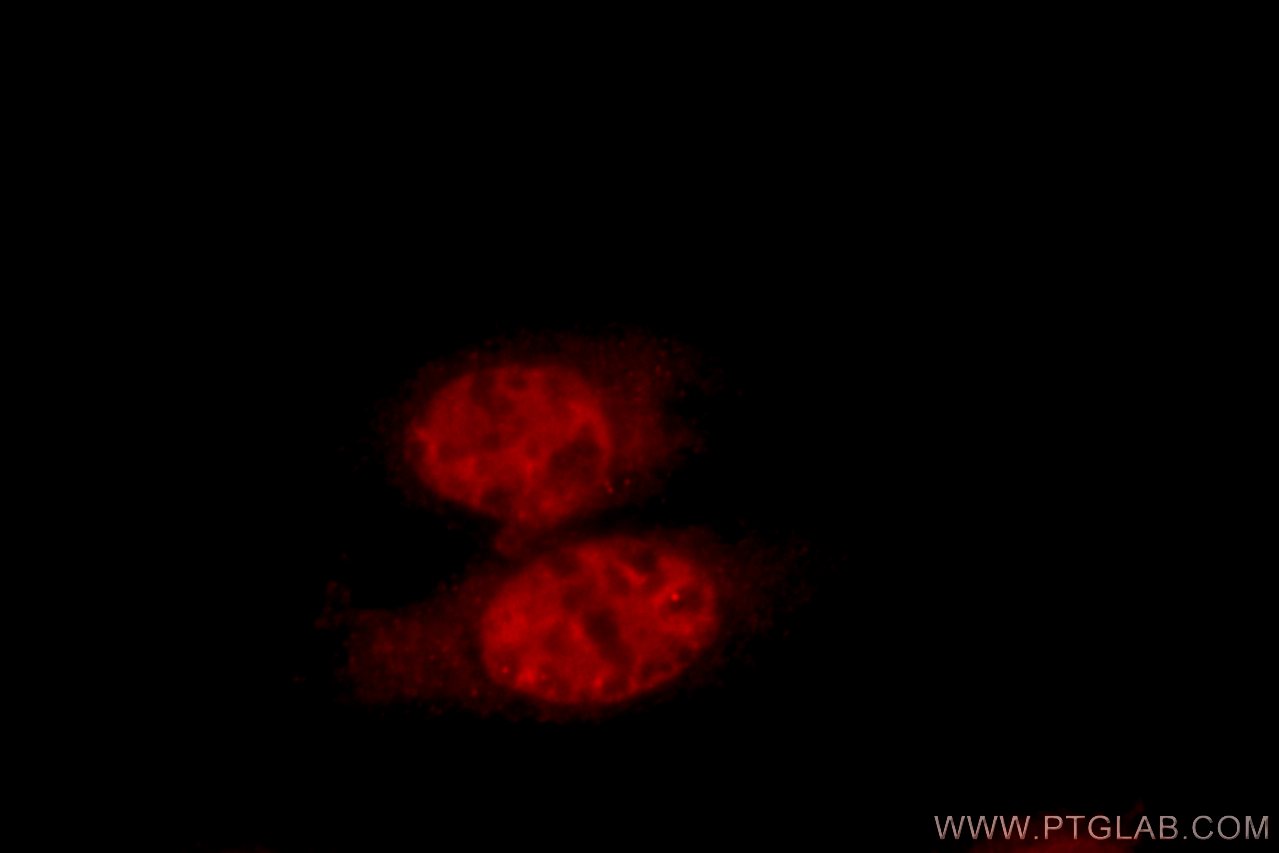 IF Staining of HepG2 using 21322-1-AP