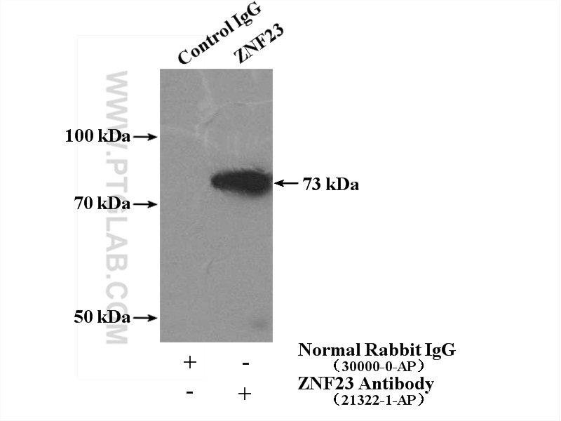 IP experiment of mouse brain using 21322-1-AP