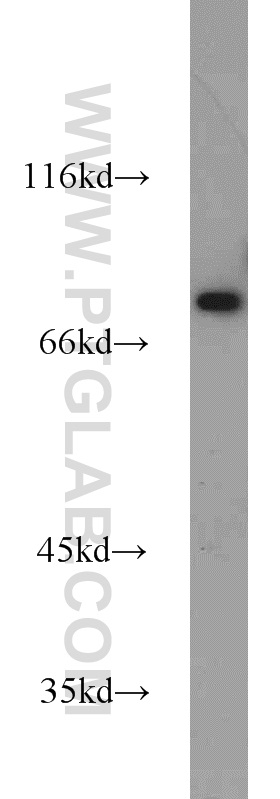 WB analysis of HepG2 using 21322-1-AP