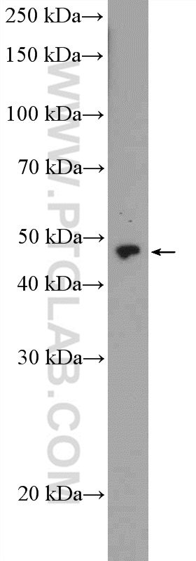 WB analysis of PC-3 using 21467-1-AP