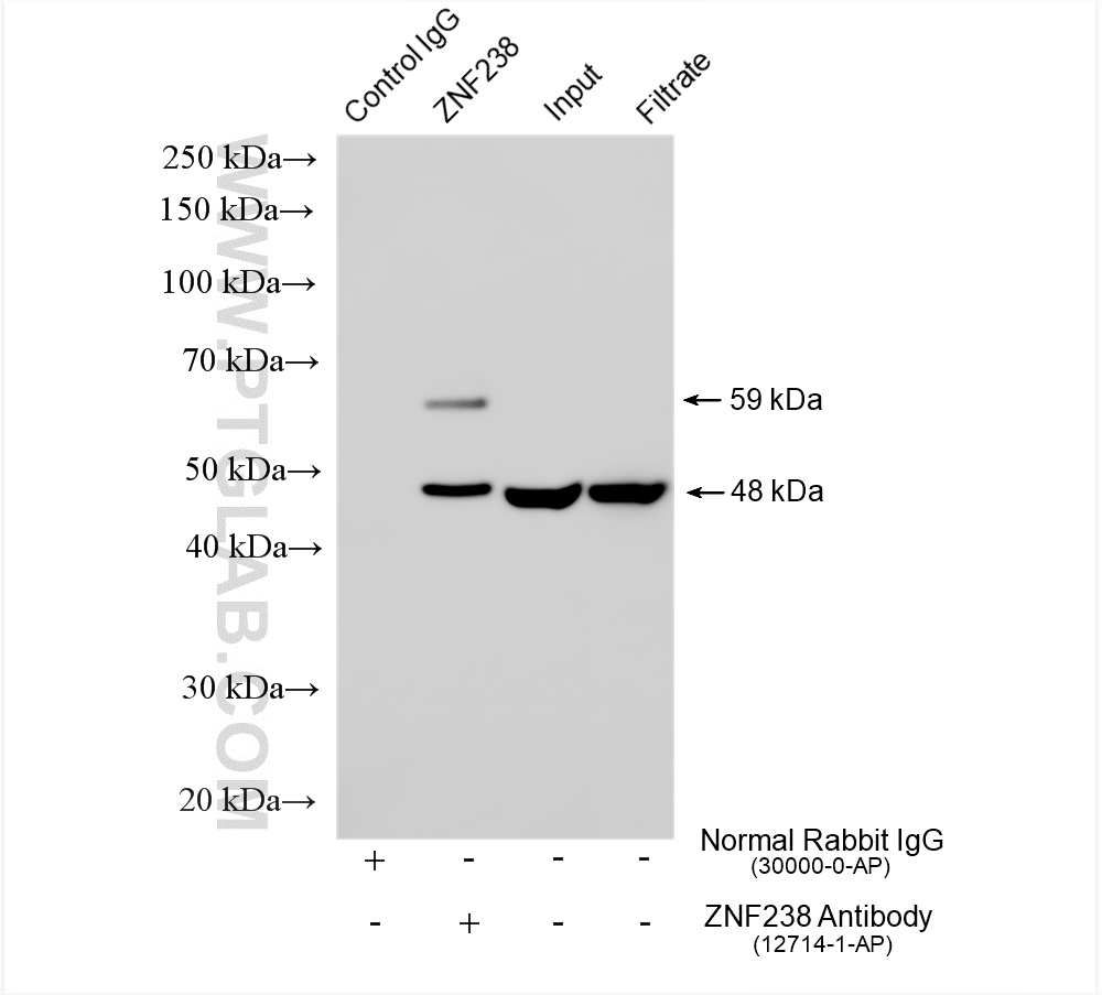 IP experiment of rat brain using 12714-1-AP