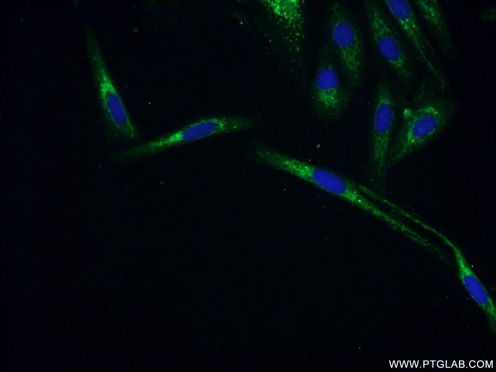 IF Staining of SKOV-3 using 25601-1-AP