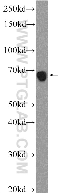 WB analysis of mouse testis using 25601-1-AP