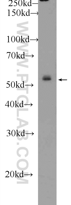 WB analysis of HepG2 using 25152-1-AP