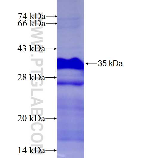 ZNF256 fusion protein Ag27658 SDS-PAGE