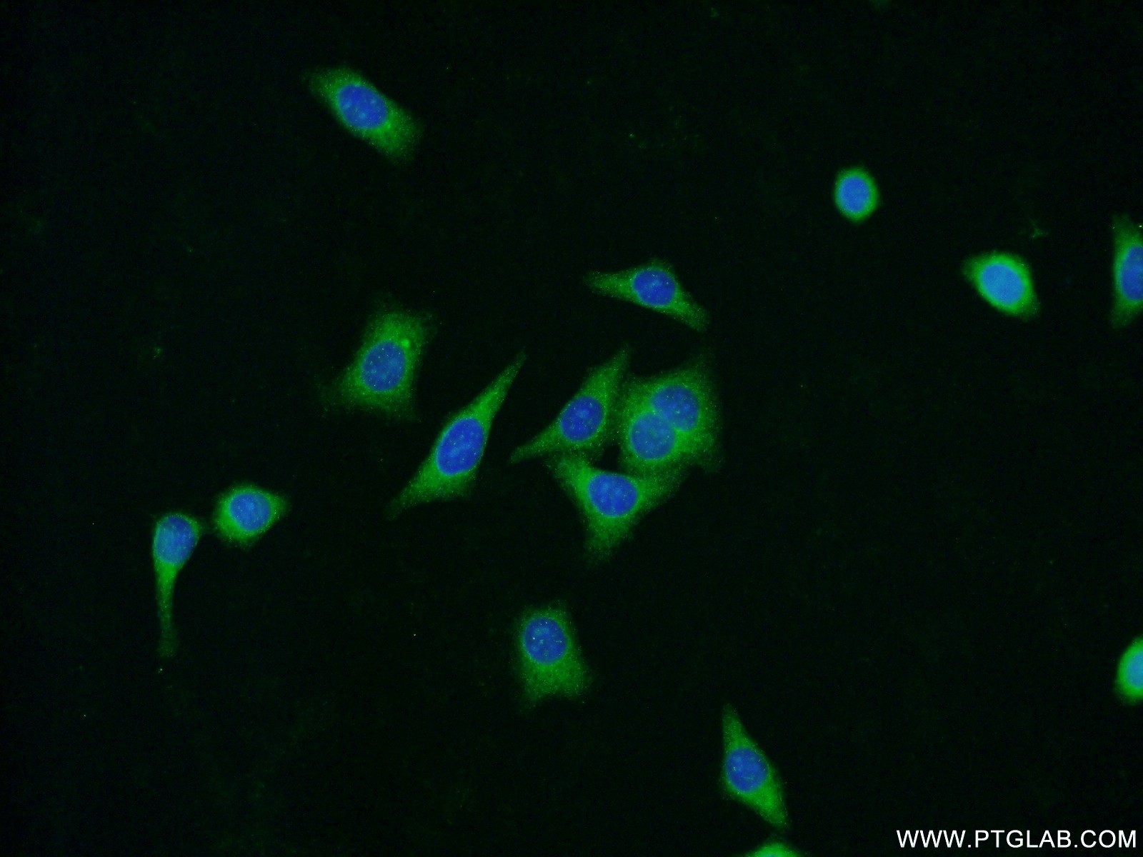 IF Staining of HepG2 using 15558-1-AP