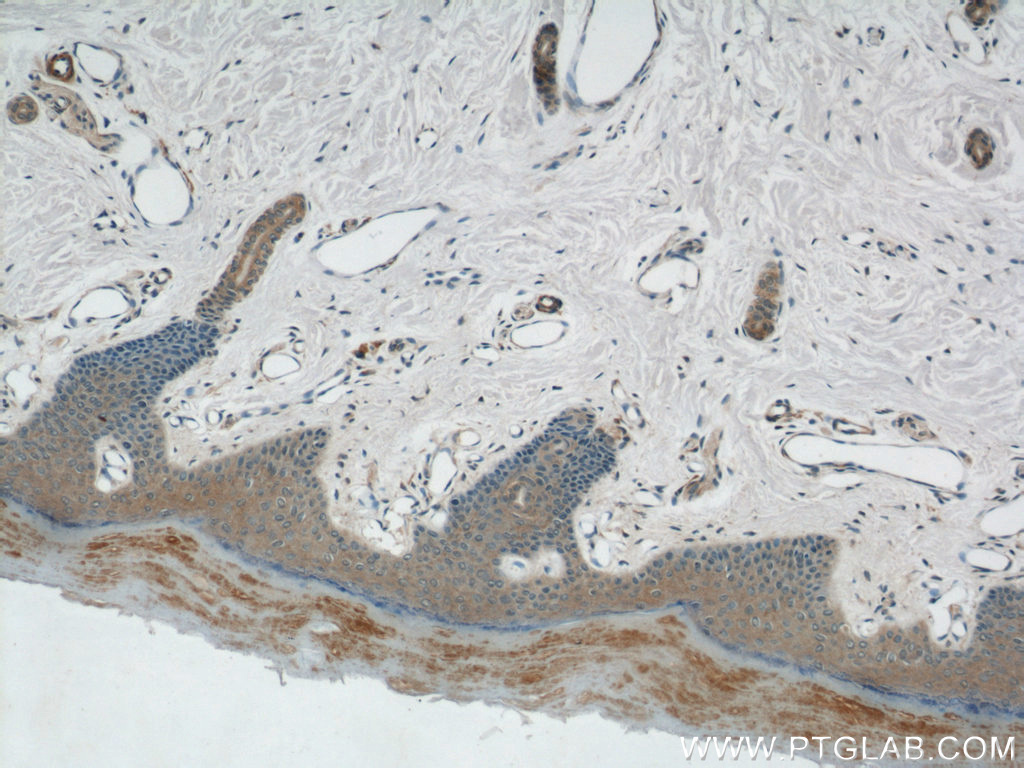 IHC staining of human skin using 15558-1-AP