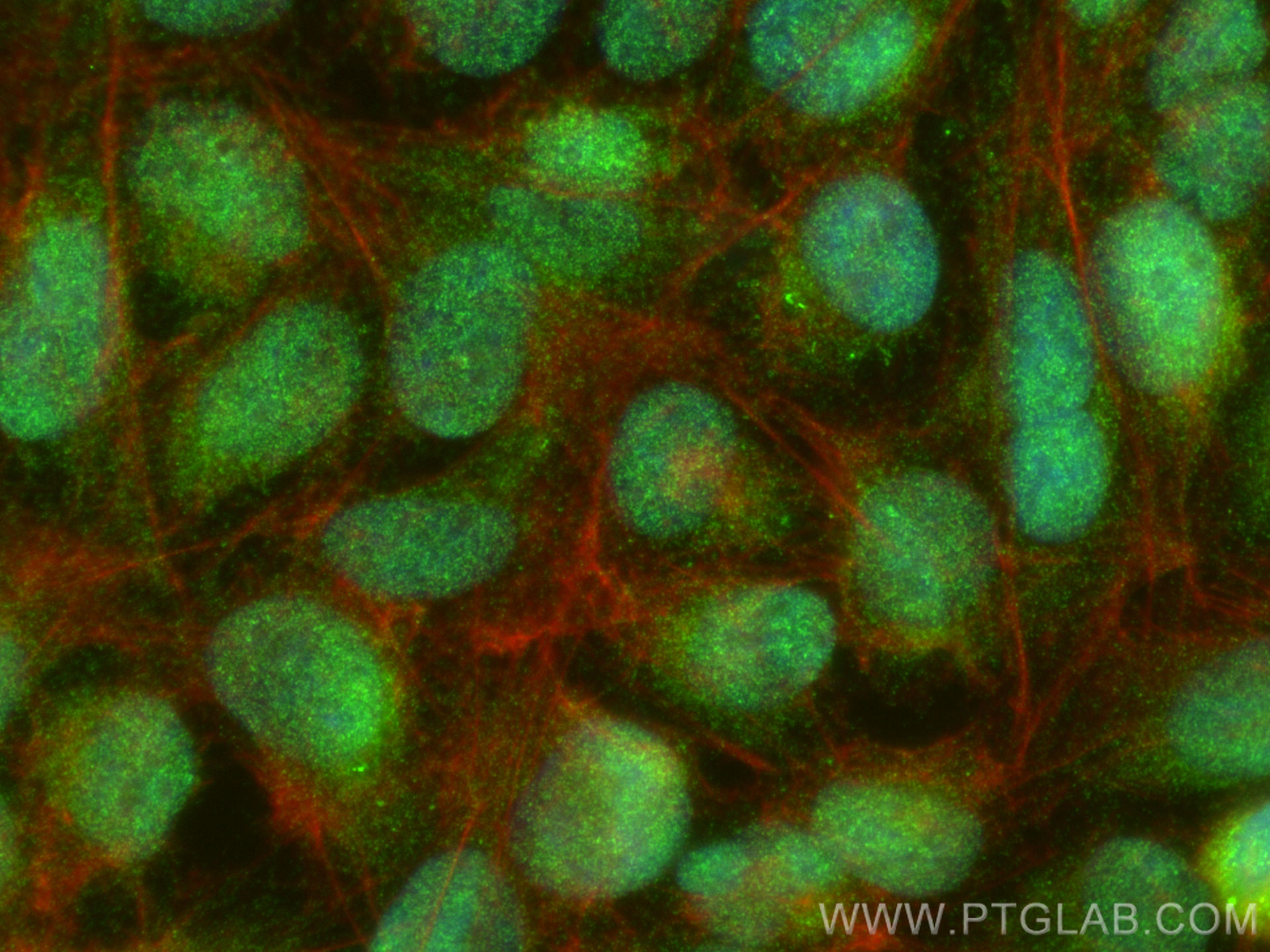 IF Staining of U2OS using 21326-1-AP