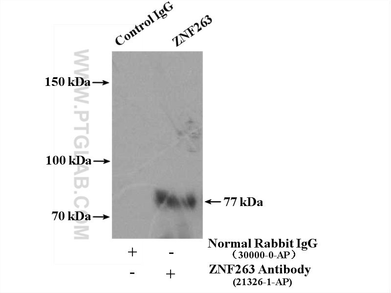 IP experiment of HepG2 using 21326-1-AP