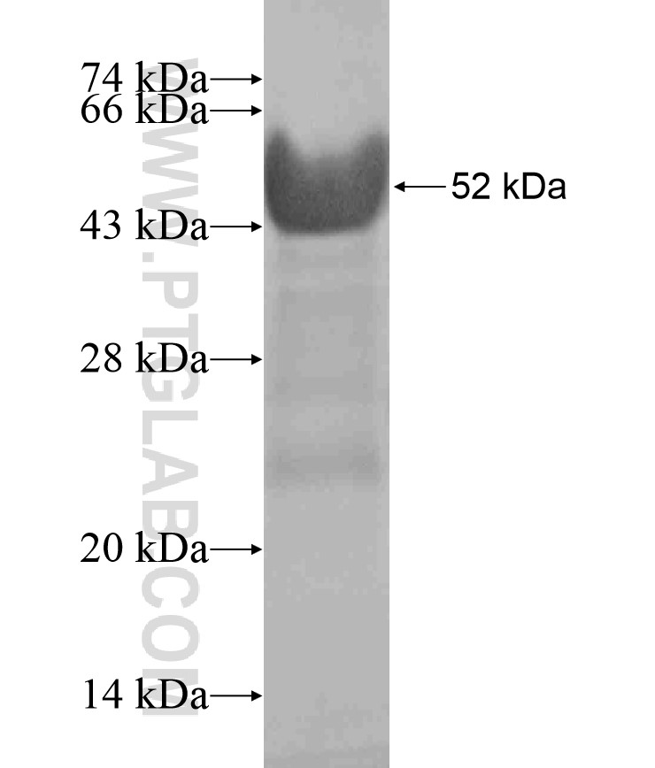 ZNF264 fusion protein Ag18205 SDS-PAGE