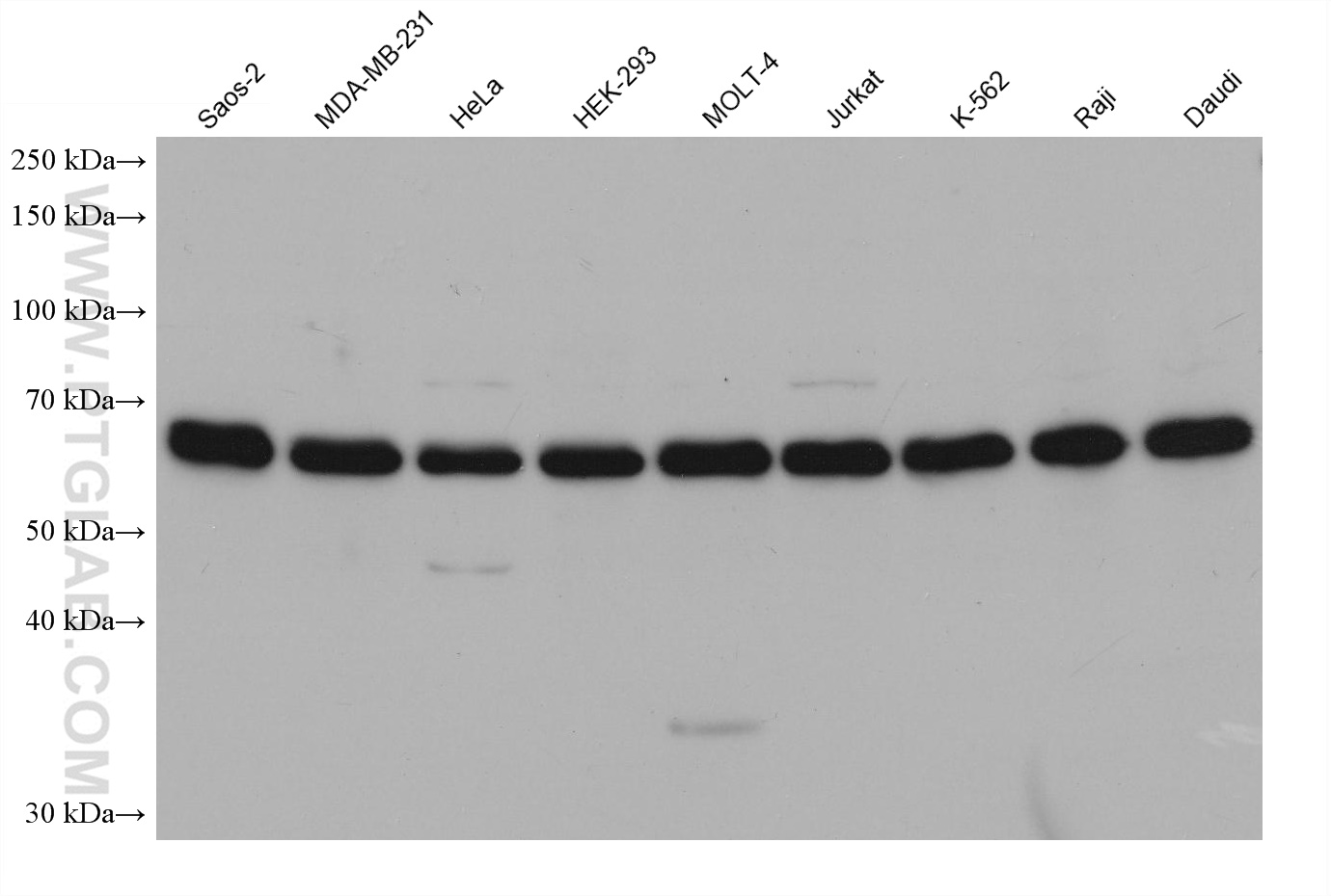 WB analysis using 68347-1-Ig