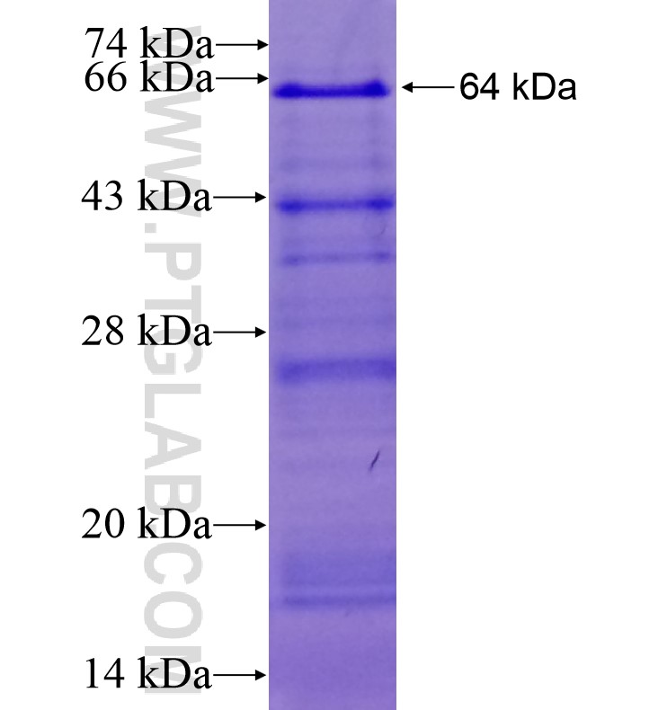 ZNF274 fusion protein Ag16295 SDS-PAGE