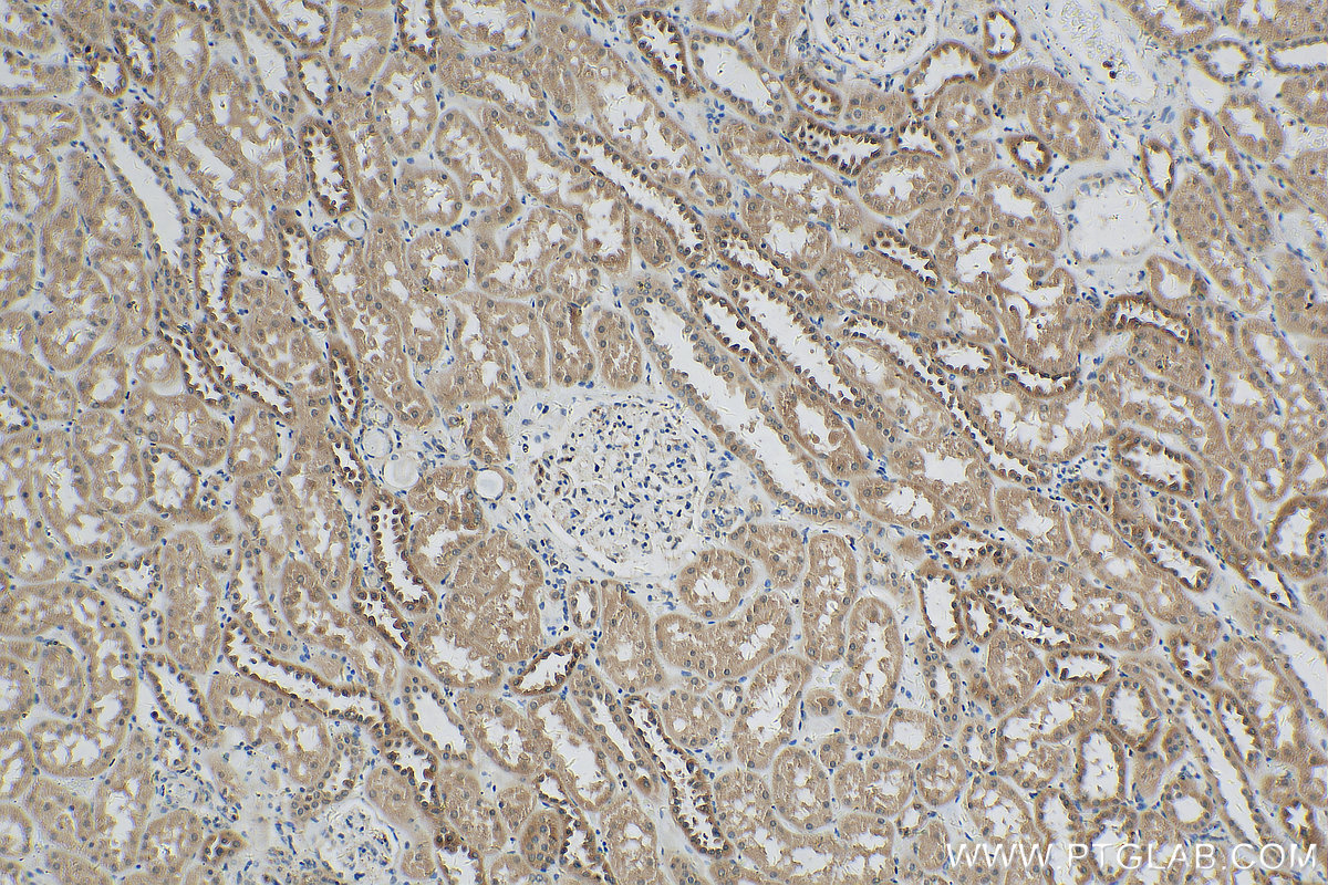 IHC staining of human kidney using 22162-1-AP