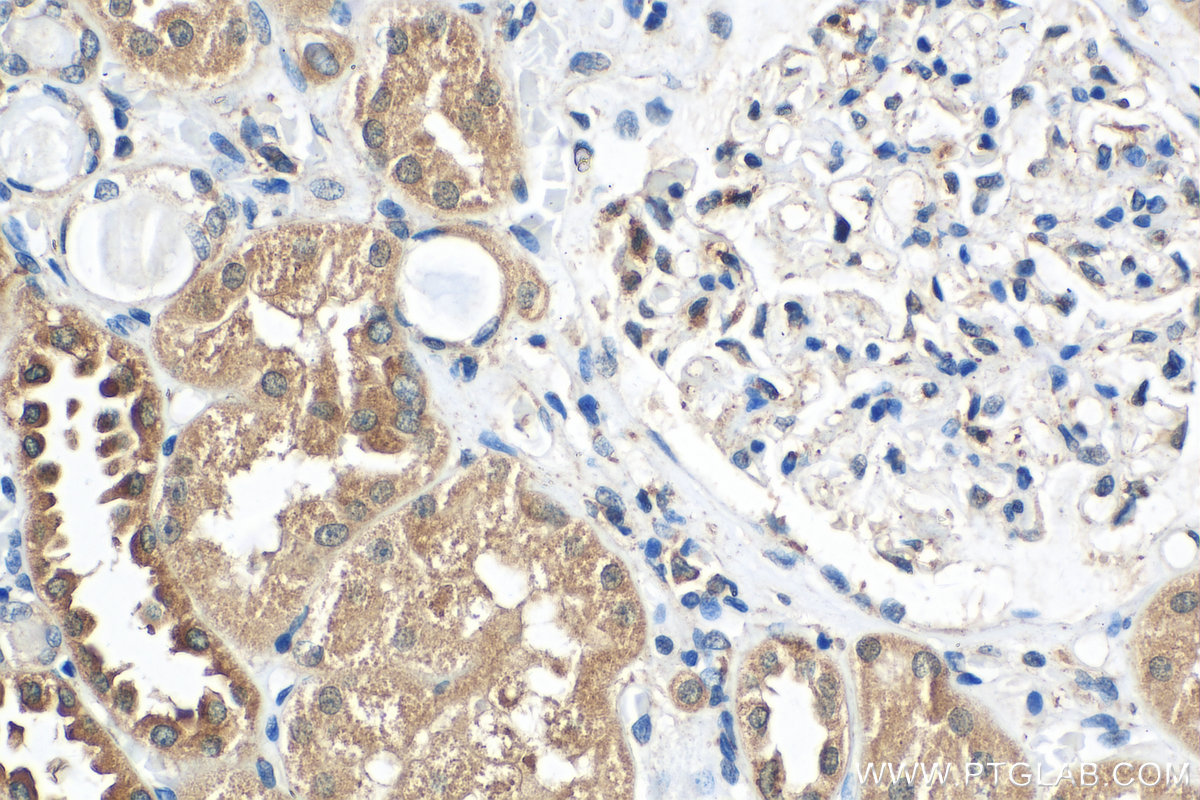 IHC staining of human kidney using 22162-1-AP