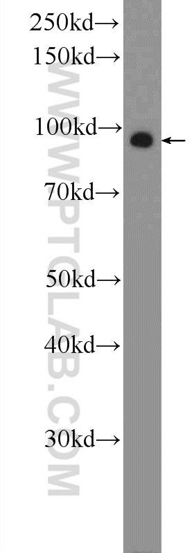 WB analysis of A549 using 22162-1-AP