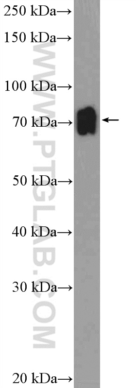 WB analysis of mouse spleen using 24952-1-AP