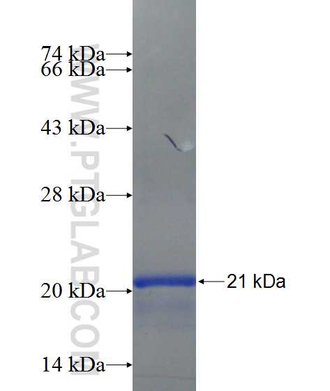 ZNF304 fusion protein Ag24454 SDS-PAGE