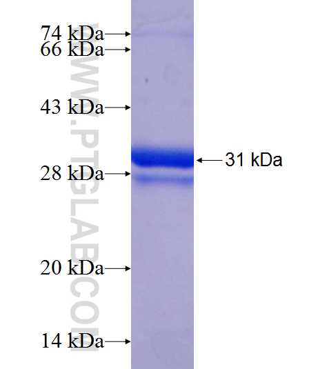 ZNF320 fusion protein Ag21730 SDS-PAGE