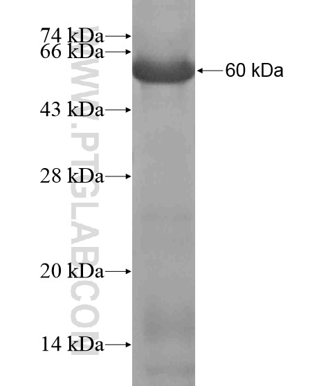 ZNF335 fusion protein Ag19893 SDS-PAGE