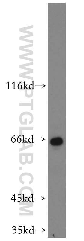 WB analysis of HeLa using 20477-1-AP