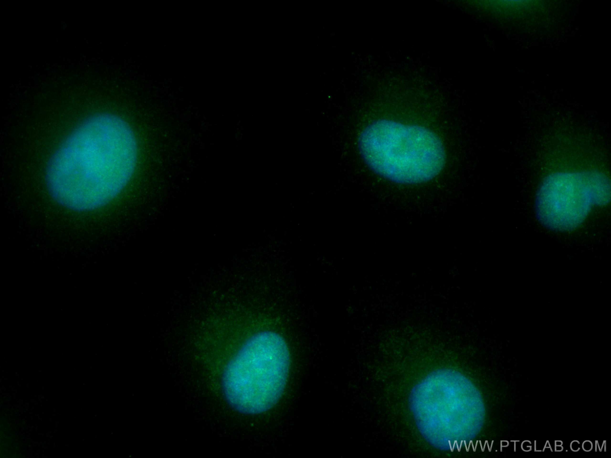 IF Staining of A549 using 20794-1-AP