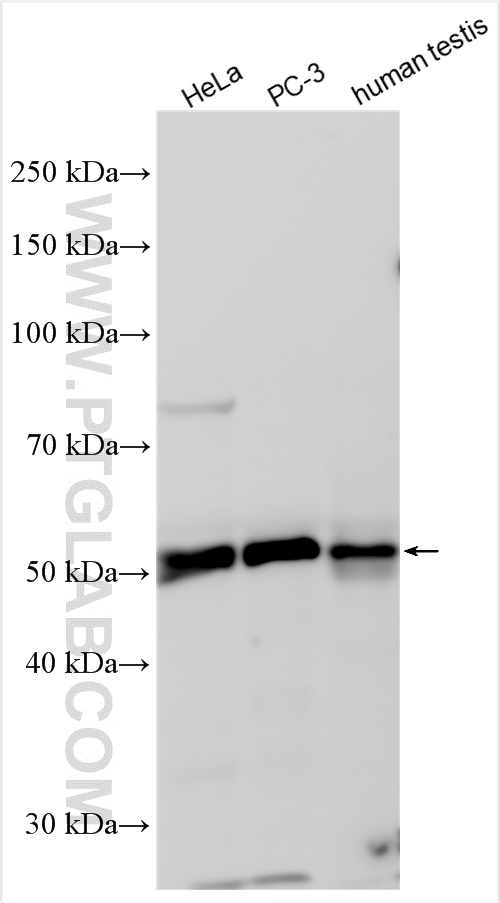 WB analysis using 16935-1-AP