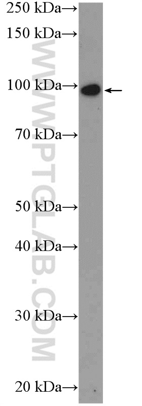 WB analysis of mouse heart using 24340-1-AP