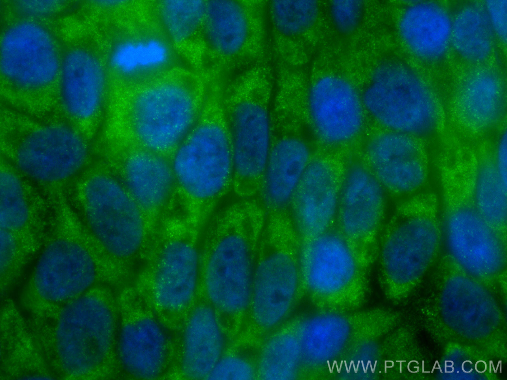 IF Staining of HaCaT using 26288-1-AP