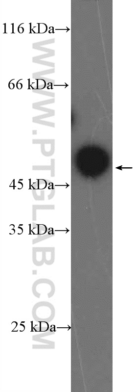 WB analysis of HeLa using 26288-1-AP