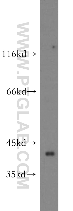 WB analysis of mouse kidney using 20806-1-AP