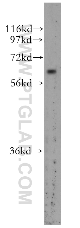 WB analysis of human brain using 11759-1-AP