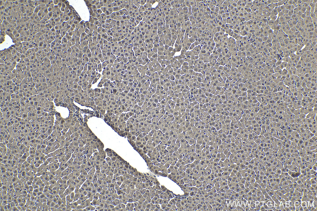 IHC staining of mouse liver using 20799-1-AP