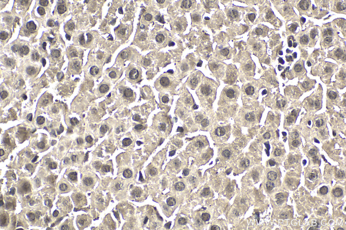 IHC staining of mouse liver using 20799-1-AP