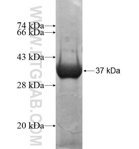 ZNF397 fusion protein Ag15222 SDS-PAGE