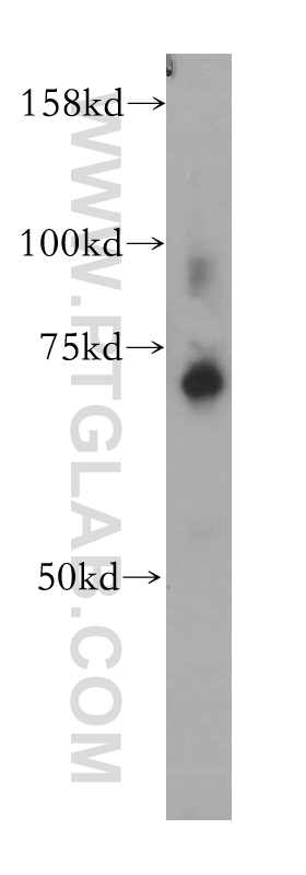 WB analysis of mouse ovary using 13667-1-AP