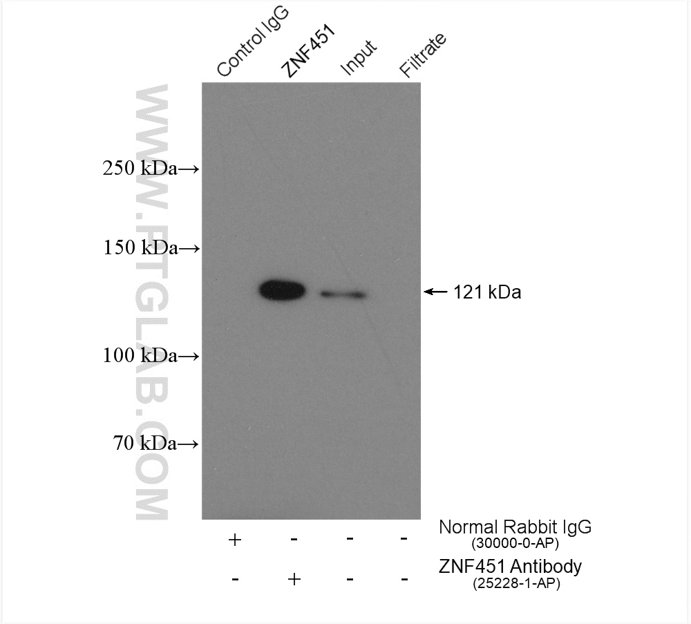 IP experiment of HeLa using 25228-1-AP