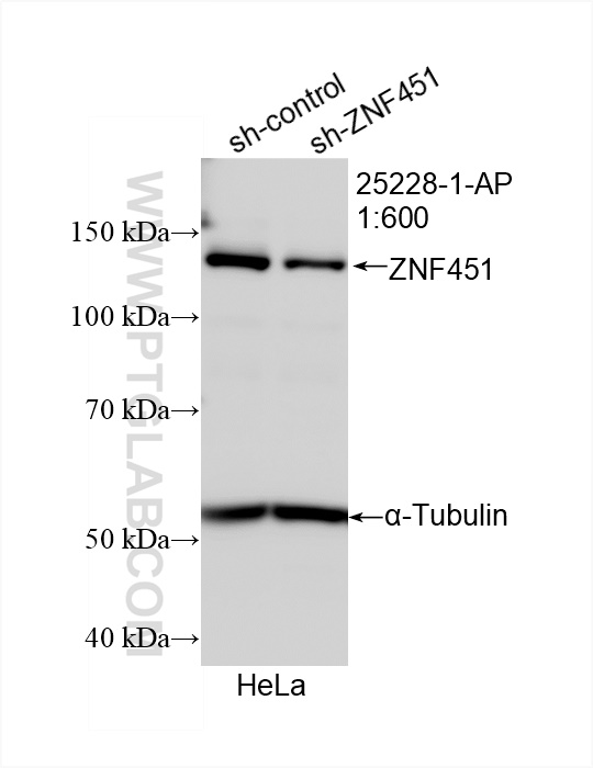 WB analysis of HeLa using 25228-1-AP