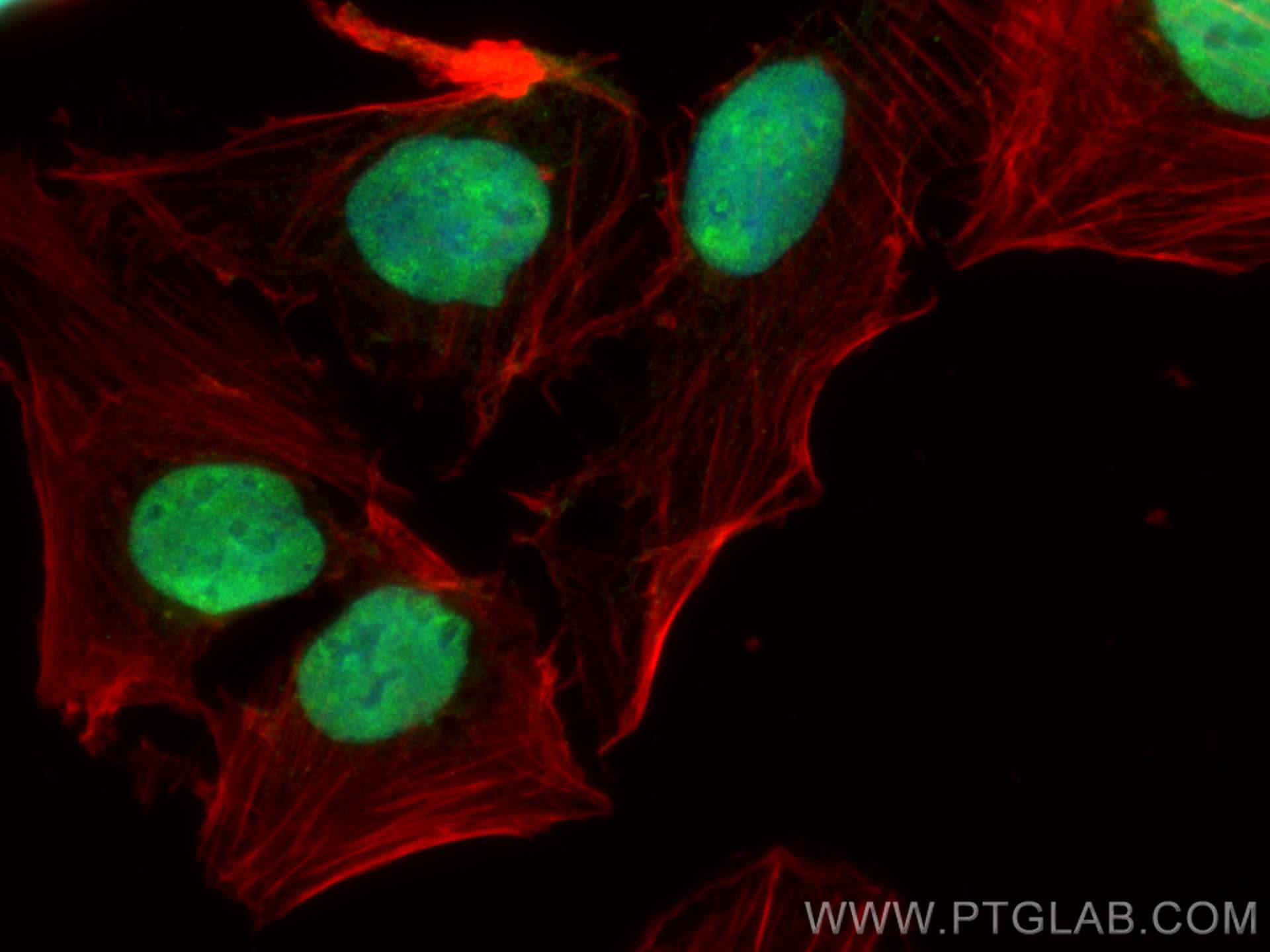 IF Staining of U2OS using 26134-1-AP