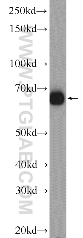 WB analysis of Jurkat using 25463-1-AP