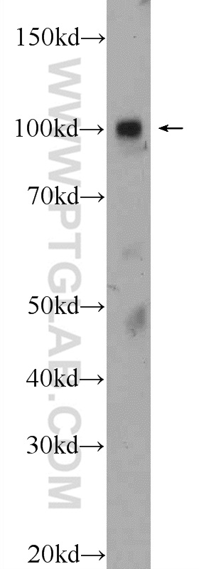 WB analysis of fetal human brain using 25242-1-AP