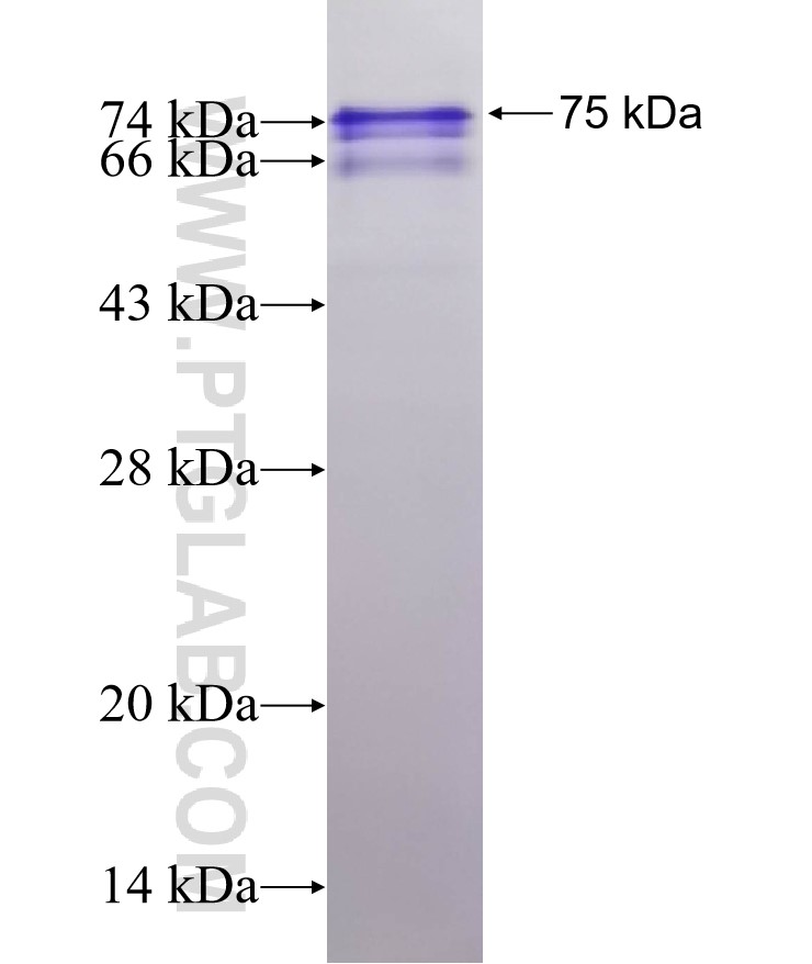 ZNF496 fusion protein Ag15015 SDS-PAGE