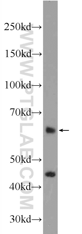 WB analysis of mouse testis using 25178-1-AP