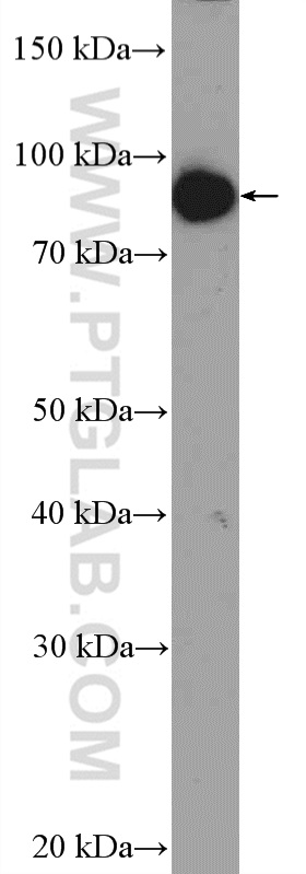 WB analysis of mouse skeletal muscle using 21772-1-AP