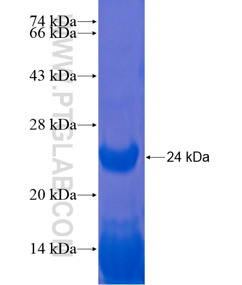 ZNF512 fusion protein Ag21602 SDS-PAGE