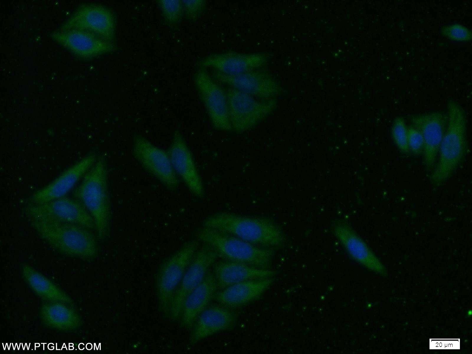 IF Staining of HepG2 using 20500-1-AP